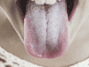 Understanding a White Tongue: Causes, Symptoms, and Treatment
