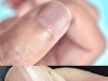 Rippled Fingernails: What They Reveal About Your Health