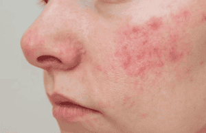 Changes in the Face That May Indicate Serious Health Issues