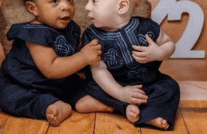 The Golden Twins: A Story of Love, Diversity, and Genetic Wonder