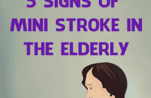 7 Signs of Mini Stroke in the Elderly – Don’t Ignore These Silent Warnings