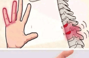 Reasons You Could Have Numbness or Tingling in Your Hands – What It Might Mean