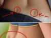See If You Have These Two Holes in Your Back – What Are Venus Dimples?