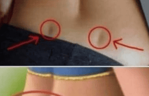 See If You Have These Two Holes in Your Back – What Are Venus Dimples?