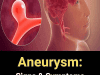 12 Signs That May Signal a Brain Aneurysm – Don’t Ignore Them