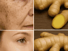 Ginger: Your Natural Secret Weapon Against Wrinkles, Freckles & Dark Spots