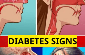 Can You Have Diabetes Without Knowing It? Discover the Key Symptoms