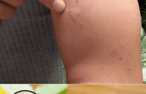 The Infallible Trap to Eliminate Houseflies β You Wonβt See Any More