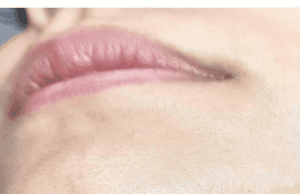 What Your Chin Hairs Might Be Revealing About Your Health