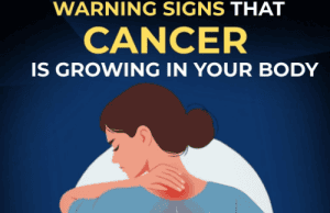 5 Warning Signs That May Indicate Cancer — And Why Early Detection Matters