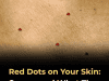 11 Common Reasons You May Notice Red Dots on Your Skin — And When to Be Concerned