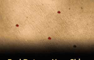 11 Common Reasons You May Notice Red Dots on Your Skin — And When to Be Concerned