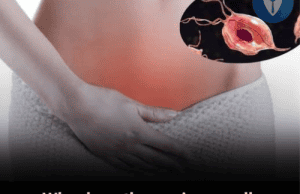 Why Does the Vagina Smell Sour? 4 Real Reasons Every Woman Should Know