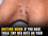 Don’t Overlook These Small Red Spots on Your Skin — They Could Be Scabies