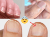 Doctor Reveals 7 Health Issues Hidden in Your Nails — What They Could Be Telling You