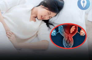 3 Intimate Habits of Husbands That May Increase Wives’ Risk of Cervical Cancer