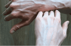 Blue Veins on Hands: What They Could Mean — And When You Should Pay Attention