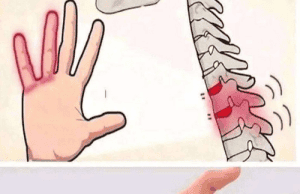 7 Common Reasons You Experience Numbness or Tingling in Your Hands